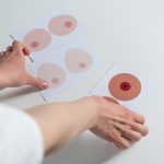 Mãos organizam ilustrações da anatomia das mamas para fins de educação e conscientização sobre o câncer de mama.