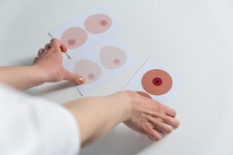 Mãos organizam ilustrações da anatomia das mamas para fins de educação e conscientização sobre o câncer de mama.
